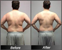 Aaron Barry - Before & After Back