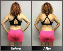 Amy Norton - Before & After Back