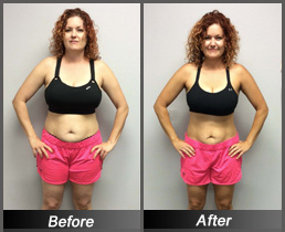 Amy Norton - Before & After Front