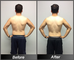 Chris Navarro - Before & After Back