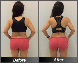 Christina Jameel - Before & After Back