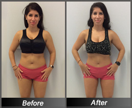Christina Jameel - Before & After Front