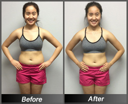 Emily Pham - Before & After Front