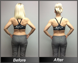 Erica Pledger - Before & After Back