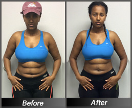 Frehiwot Hobe - Before & After Front