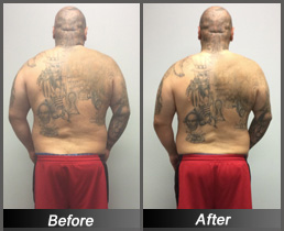 John Guerrero - Before & After Back