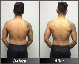 Justin Soria - Before & After Back