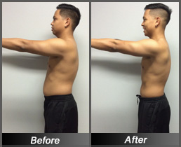 Justin Soria - Before & After Side