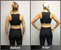 Karissa Schneider - Before & After Back
