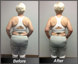 Mechele Griffin - Before & After Back