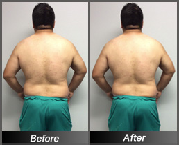 Pablo Arriaga - Before & After Back