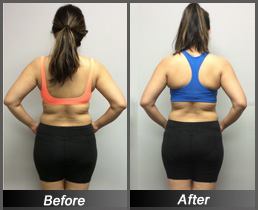 Tam Quy - Before & After Back