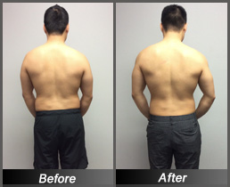 Wes Yang - Before & After Back