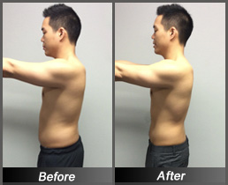 Wes Yang - Before & After Side